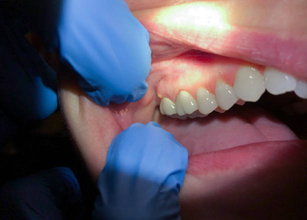 Best Pediatric Emergency Dentist in Denison, IA